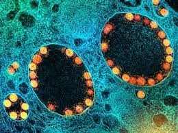 Partículas del virus SARS-CoV-2 (en amarillo) dentro de los endosomas de una célula epitelial nasal muy infectada. National Institute of Allergy and Infectious Diseases (NIAID), CC BY-SA
